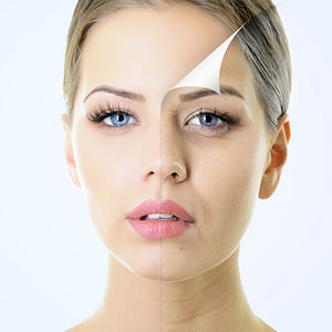 ¿Cómo mejorar tu aspecto estética facial y mesoterapia corporal?